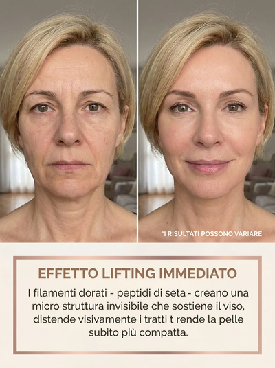 BioAvrenza™ – Siero Coreano