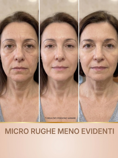 BioAvrenza™ – Siero Coreano